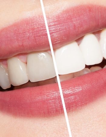 Oatlands Dental Lounge