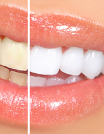 Millbank Dental Care