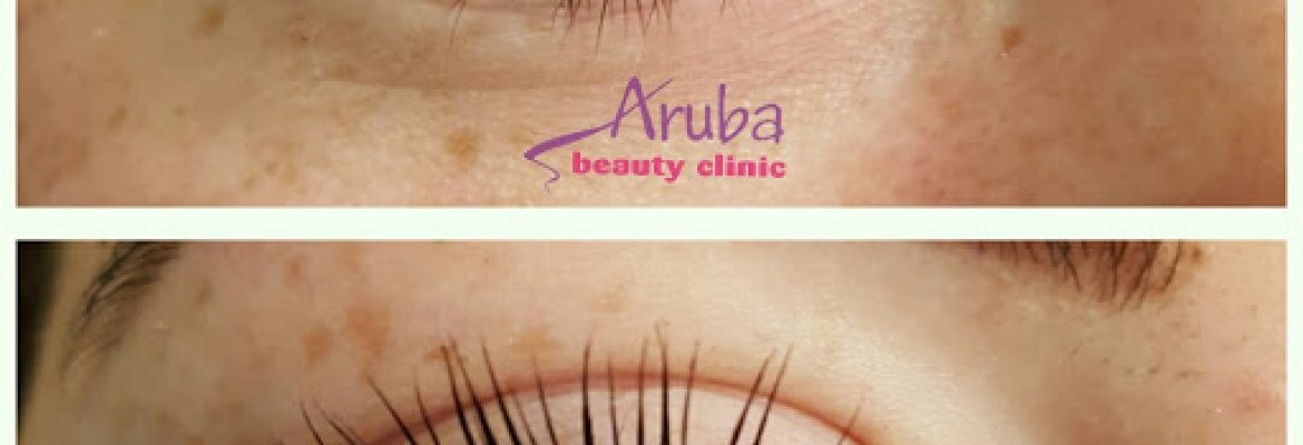 Aruba Beauty Clinic – newcastle