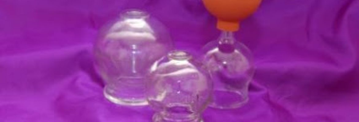 Cupping Therapy – coventry