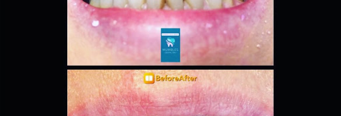 Mumbles Dental Spa – Swansea