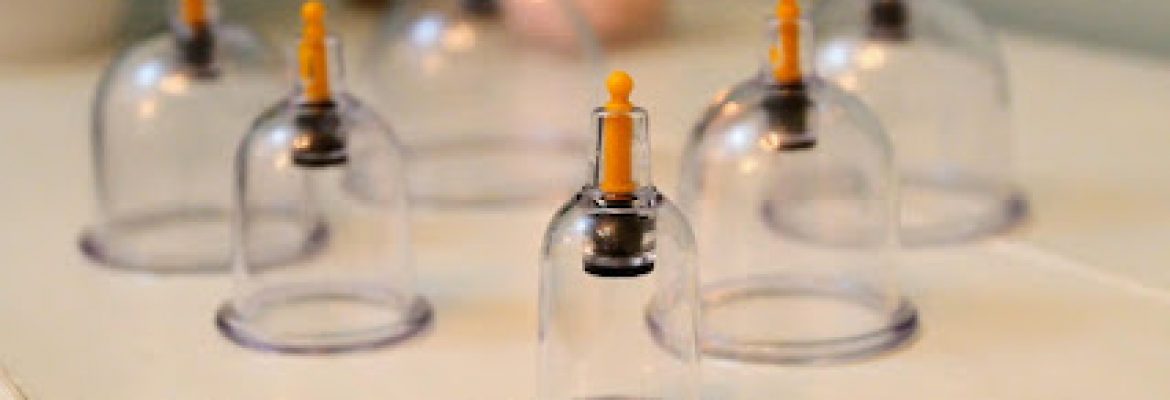 mobile cupping therapy – Bolton