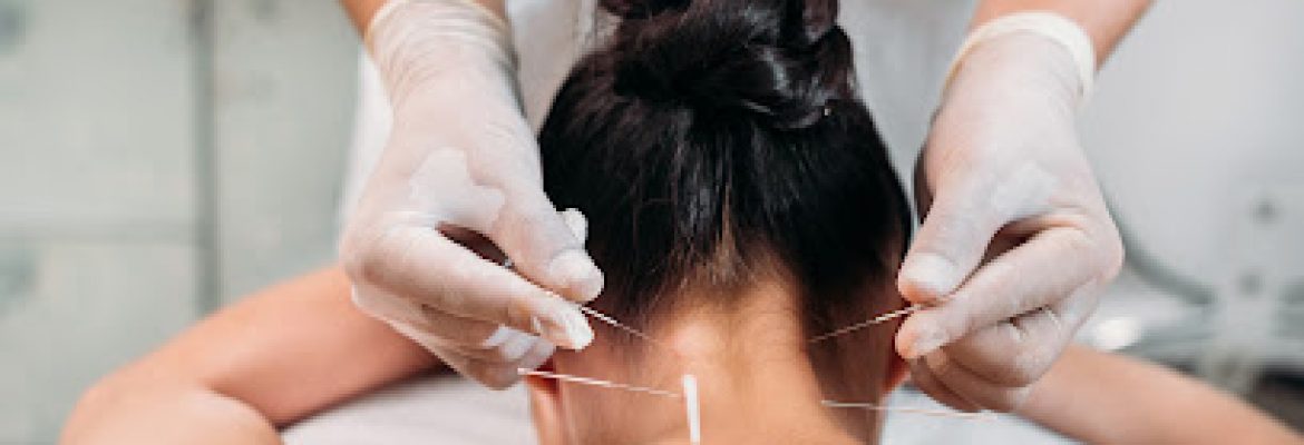 Remedial Massage And Dry Needling – sydney